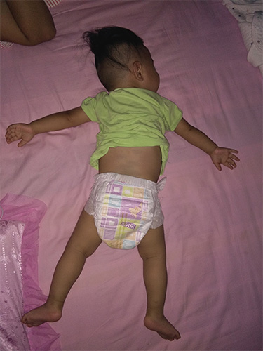 diapers-5, KOSA